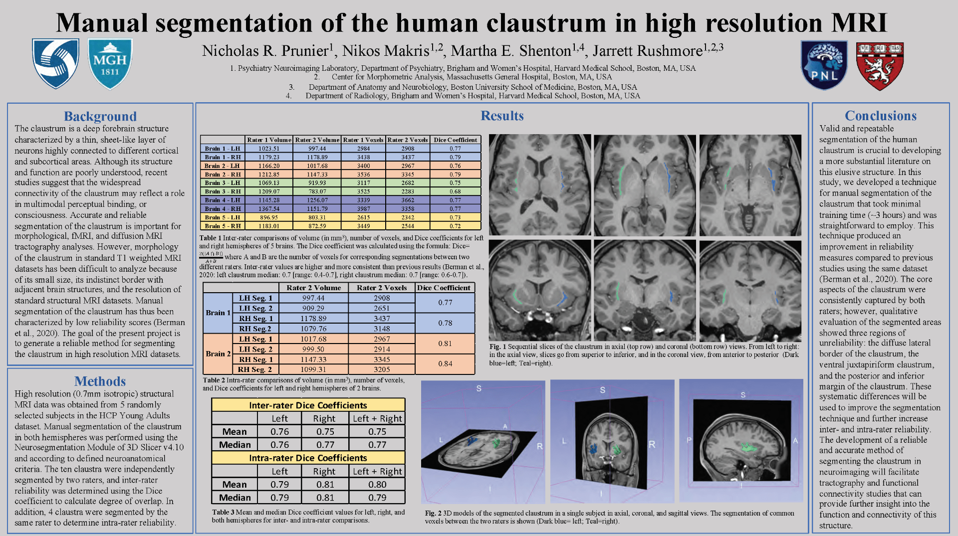 Manual segmentation of the human claustrum in high resolution MRI